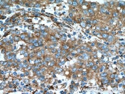 SECTM1 Mouse anti-Human, Clone: 1C11B4, Proteintech:Antibodies:Primary