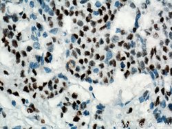 P53 Mouse anti-Human, Rat, Clone: 6C4B6, Proteintech:Antibodies:Primary