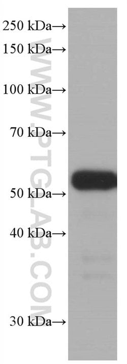 P53 Mouse anti-Human, Rat, Clone: 6C4B6, Proteintech:Antibodies:Primary