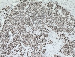 P53 Mouse anti-Human, Rat, Clone: 6C4B6, Proteintech:Antibodies:Primary