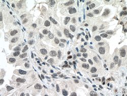P53 Mouse anti-Human, Rat, Clone: 6C4B6, Proteintech:Antibodies:Primary