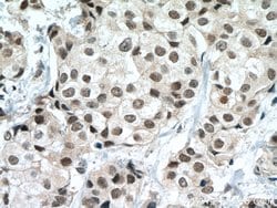 P53 Mouse anti-Human, Rat, Clone: 6C4B6, Proteintech:Antibodies:Primary