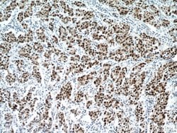 P53 Mouse anti-Human, Rat, Clone: 6C4B6, Proteintech:Antibodies:Primary