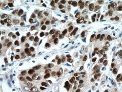 P53 Mouse anti-Human, Rat, Clone: 6C4B6, Proteintech:Antibodies:Primary