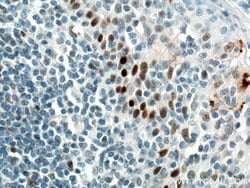 P53 Mouse anti-Human, Rat, Clone: 6C4B6, Proteintech:Antibodies:Primary