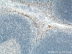 P53 Mouse anti-Human, Rat, Clone: 6C4B6, Proteintech:Antibodies:Primary