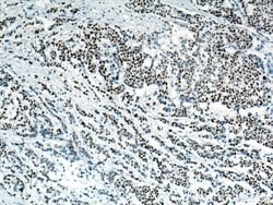 P53 Mouse anti-Human, Rat, Clone: 6C4B6, Proteintech:Antibodies:Primary