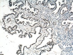 P53 Mouse anti-Human, Rat, Clone: 6C4B6, Proteintech:Antibodies:Primary