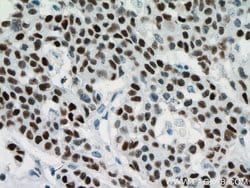 P53 Mouse anti-Human, Rat, Clone: 6C4B6, Proteintech:Antibodies:Primary