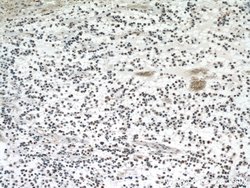 P53 Mouse anti-Human, Rat, Clone: 6C4B6, Proteintech:Antibodies:Primary