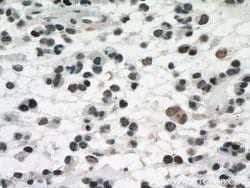 P53 Mouse anti-Human, Rat, Clone: 6C4B6, Proteintech:Antibodies:Primary