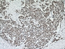 P53 Mouse anti-Human, Rat, Clone: 6C4B6, Proteintech:Antibodies:Primary