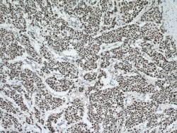P53 Mouse anti-Human, Rat, Clone: 6C4B6, Proteintech:Antibodies:Primary