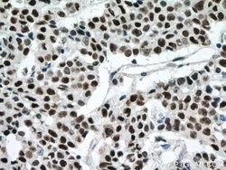 P53 Mouse anti-Human, Rat, Clone: 6C4B6, Proteintech:Antibodies:Primary