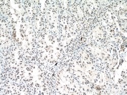P53 Mouse anti-Human, Rat, Clone: 6C4B6, Proteintech:Antibodies:Primary