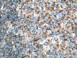 CD45 Mouse anti-Human, Porcine, Clone: 4E9B2, Proteintech:Antibodies:Primary