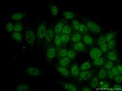 RBM4 Mouse anti-Human, Clone: 3H3F12, Proteintech:Antibodies:Primary Antibodies