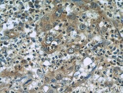 RBM4 Mouse anti-Human, Clone: 3H3F12, Proteintech:Antibodies:Primary Antibodies