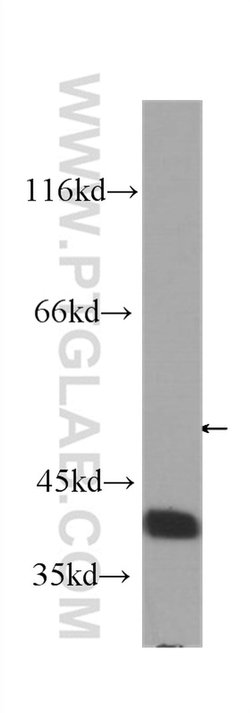 RBM4 Mouse anti-Human, Clone: 3H3F12, Proteintech:Antibodies:Primary Antibodies
