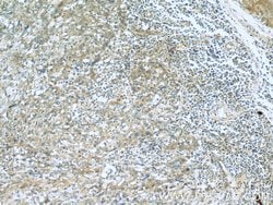 RBM4 Mouse anti-Human, Clone: 3H3F12, Proteintech:Antibodies:Primary Antibodies