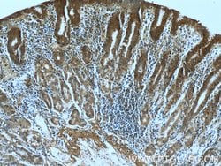 RBM4 Mouse anti-Human, Clone: 3H3F12, Proteintech:Antibodies:Primary Antibodies