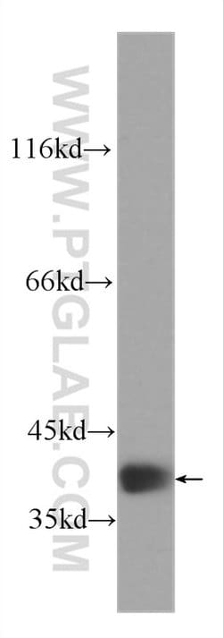 RBM4 Mouse anti-Human, Clone: 3H3F12, Proteintech:Antibodies:Primary Antibodies