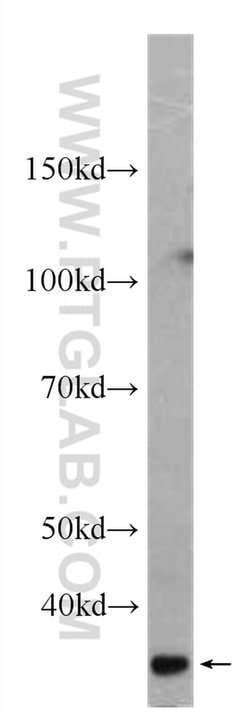 SCGF Mouse anti-Human, Clone: 4H11E4, Proteintech 20 &mu;L; Unconjugated 