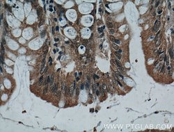 IL37 Mouse anti-Human, Clone: 7F1A1, Proteintech:Antibodies:Primary Antibodies