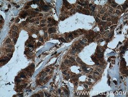IL37 Mouse anti-Human, Clone: 7F1A1, Proteintech:Antibodies:Primary Antibodies