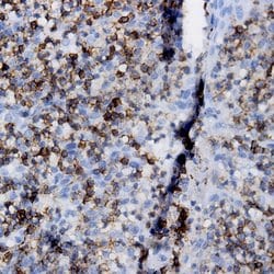 Kappa Light Chain Monoclonal Antibody (K88), Abbomax 100 &mu;g | Buy Online | Abbomax Inc | Fisher Scientific