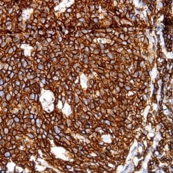 CD45 (Leukocyte common antigen, LCA) Monoclonal Antibody (HI30), Abbomax