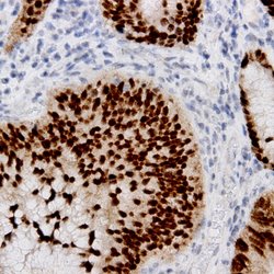 Estrogen Receptor (ER) Monoclonal Antibody (ER88), Abbomax 100 &mu;g; Unconjugated:Antibodies,
