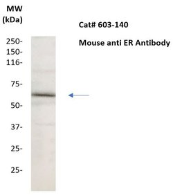 Estrogen Receptor (ER) Monoclonal Antibody (ER88), Abbomax 100 &mu;g; Unconjugated:Antibodies,