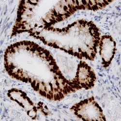 Estrogen Receptor, alpha (ER alpha) Monoclonal Antibody (ERA), Abbomax