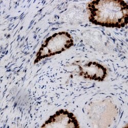 Estrogen Receptor, beta (ER beta) Monoclonal Antibody (ERB), Abbomax 100