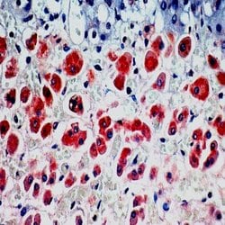 Multi-Drug Resistance Marker (P-Glycoprotein) Monoclonal Antibody (ABM137),