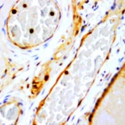 FSH b-subunit Monoclonal Antibody (ABM601), Abbomax 100 &mu;g; Unconjugated:Antibodies,