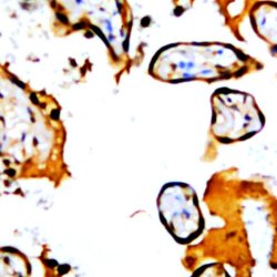 FSH Monoclonal Antibody (FB2), Abbomax 100 &mu;g; Unconjugated:Antibodies,