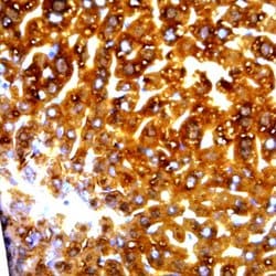 HBeAg Monoclonal Antibody (ABM042), Abbomax 100 &mu;g | Buy Online | Abbomax Inc | Fisher Scientific