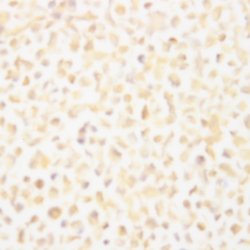 HIV, p18 Monoclonal Antibody (ABM075), Abbomax 100 &mu;g; Unconjugated:Antibodies,