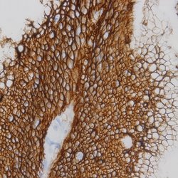 PSA Monoclonal Antibody (A67-B/E3), Abbomax 100 &mu;g | Buy Online | Abbomax Inc | Fisher Scientific