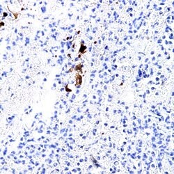 TSH b-subunit Monoclonal Antibody (ABM801), Abbomax 100 &mu;g; Unconjugated:Antibodies,