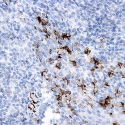 Myosin Heavy Chain, Cardiac Monoclonal Antibody (9G11), Abbomax 100 &mu;g;