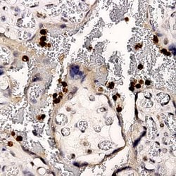 Uroplakin-2 Monoclonal Antibody (ABM146), Abbomax 100 &mu;g; Unconjugated:Antibodies,