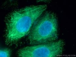 BID Mouse anti-Human, Clone: 2A2E5, Proteintech:Antibodies:Primary Antibodies