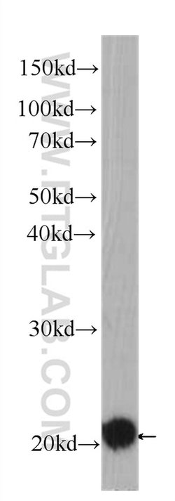 BID Mouse anti-Human, Clone: 2A2E5, Proteintech:Antibodies:Primary Antibodies