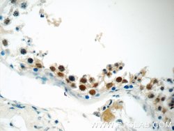 SIRT1 Mouse anti-Human, Mouse, Clone: 7F6G6, Proteintech:Antibodies:Primary