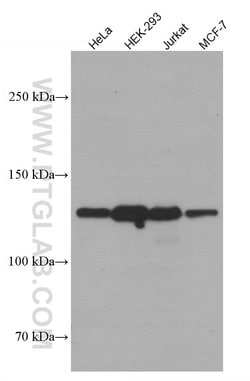 SIRT1 Mouse anti-Human, Mouse, Clone: 7F6G6, Proteintech:Antibodies:Primary