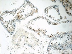 SIRT1 Mouse anti-Human, Mouse, Clone: 7F6G6, Proteintech:Antibodies:Primary