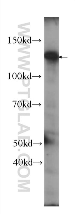 SIRT1 Mouse anti-Human, Mouse, Clone: 7F6G6, Proteintech:Antibodies:Primary